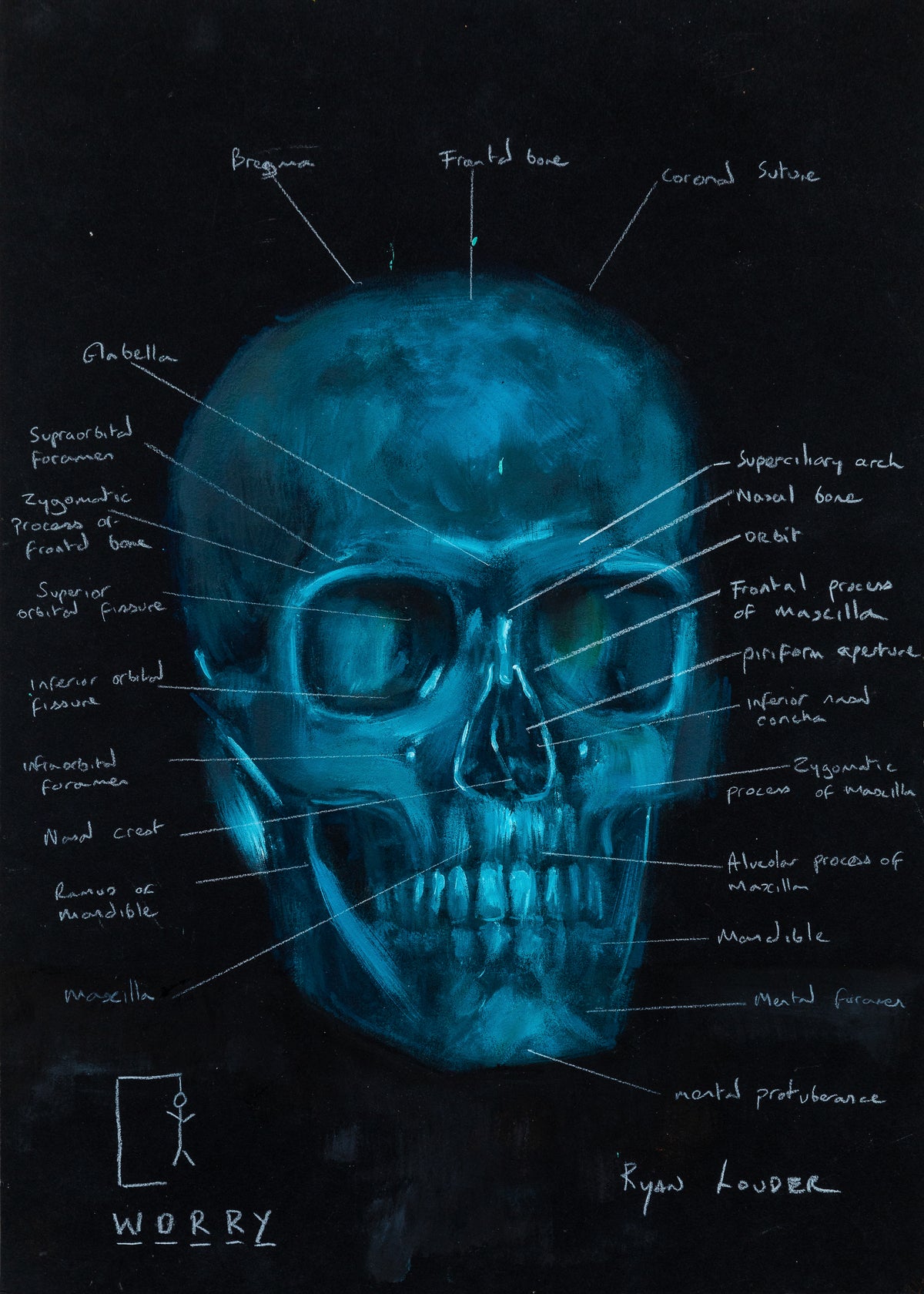 Thinking Too Much Skull by Ryan Louder